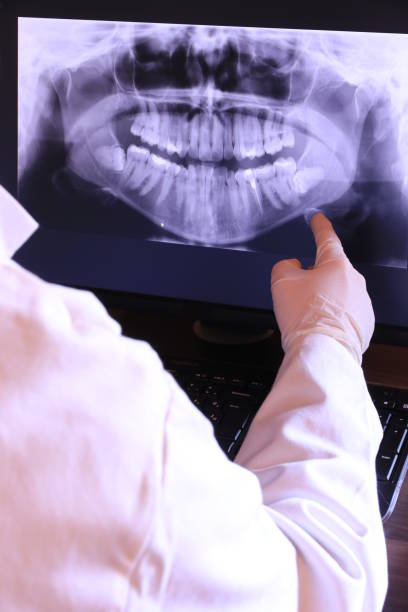 Best Emergency Tooth Extraction in Edenton, NC